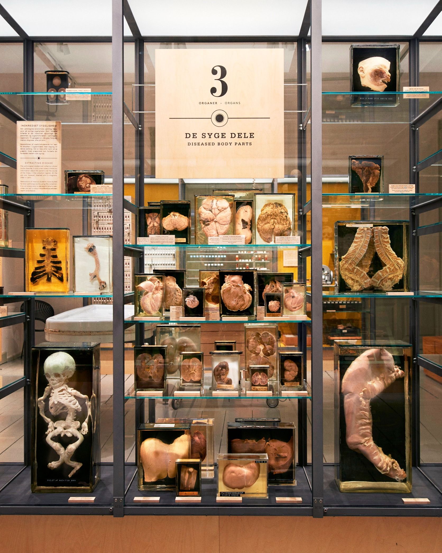 A display of diseased organs and body parts at Copenhagen’s Medical Museion