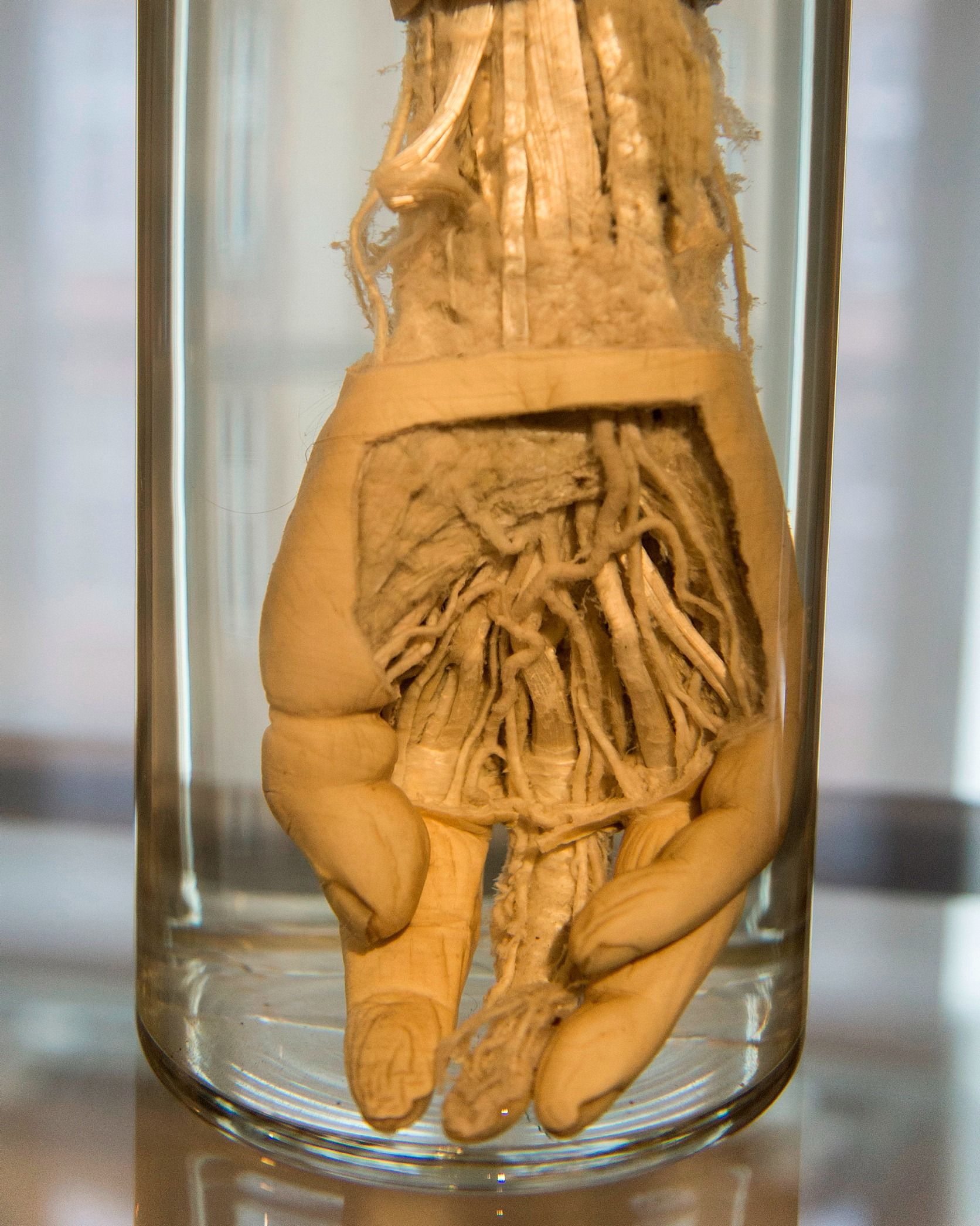 A yellowed hand in a jar, with the skin of the palm stripped away to reveal veins and tendons, at the Medical Museion